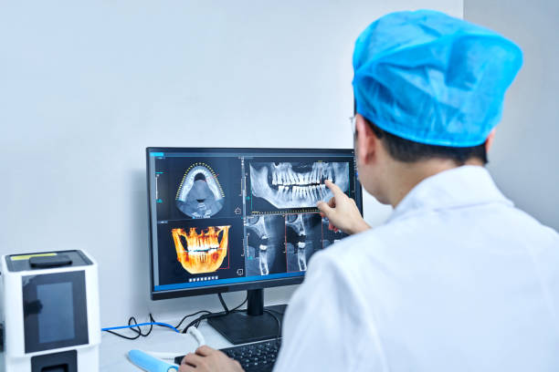 Best Emergency Root Canal Treatment in Bremen, IN